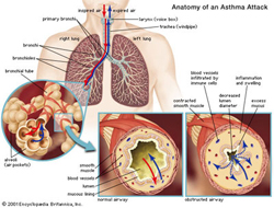 anatomy of an asthma attack photo